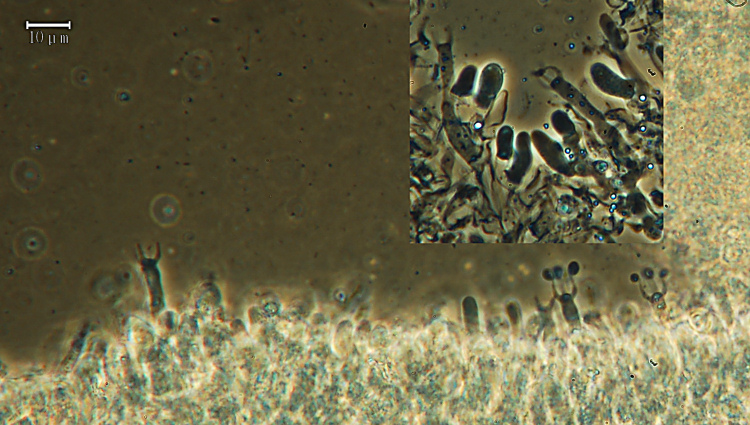 Crosta bianca su faggio - foto 5383 (Sistotrema sernanderi)